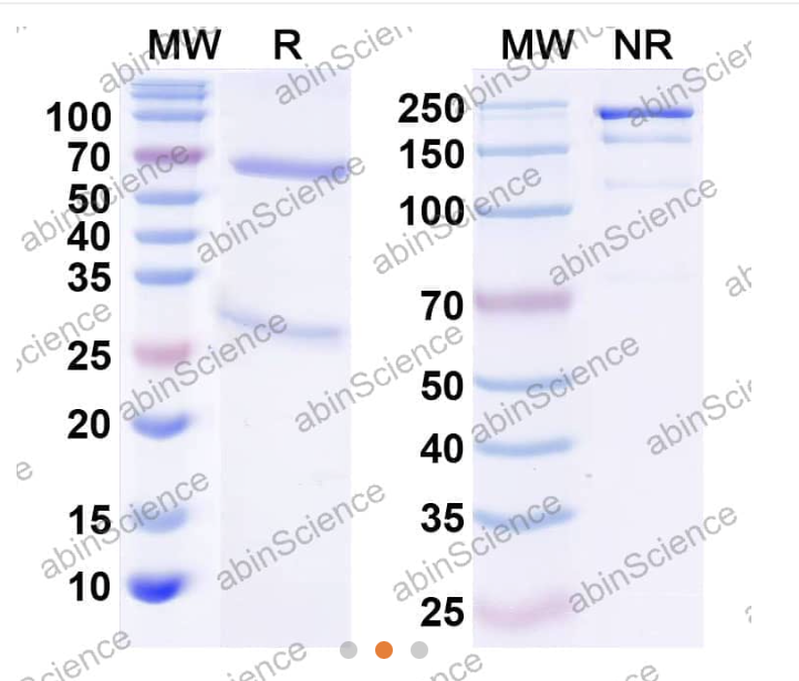 AbinScience InVivoMAb Anti-Human 4-1BB Ligand/TNFSF9 Antibody (Iv0138) (HC336020-100UG)