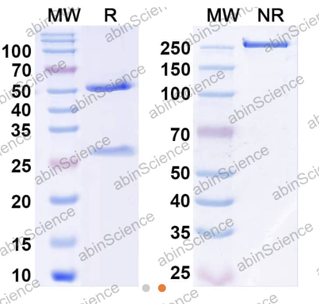 AbinScience InVivoMAb Anti-Human Complement Factor D/Adipsin Antibody (Iv0118) (HF697010-50UG)