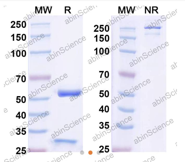 AbinScience InVivoMAb Anti-Human Osteopontin/OPN Antibody (Iv0103) (HY207010-50UG)