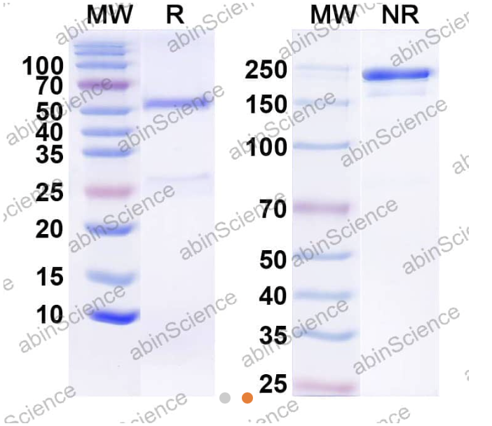 AbinScience InVivoMAb Anti-Human FGF-21 Antibody (Iv0067) (HV802010-100UG)