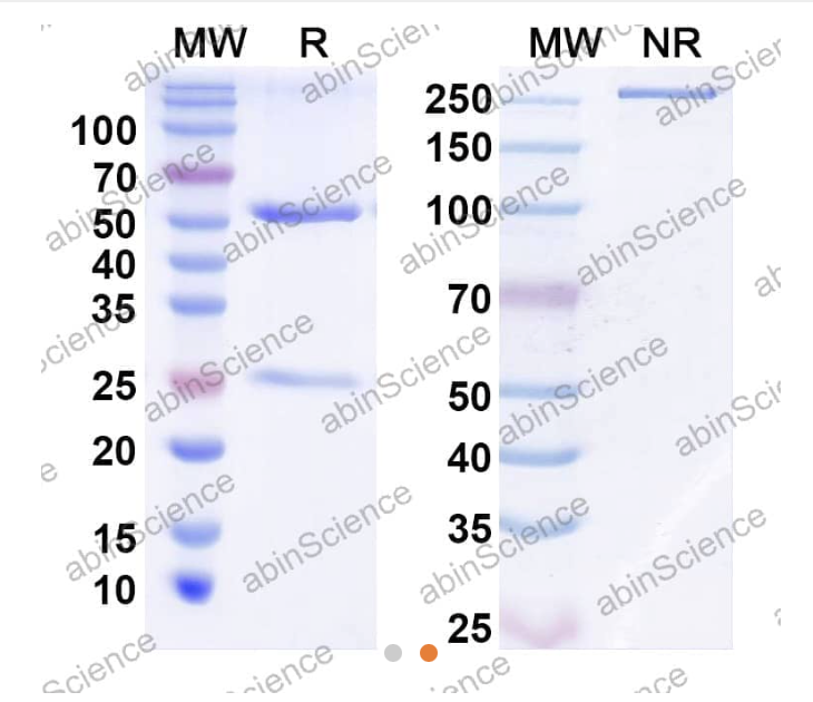 AbinScience InVivoMAb Anti-Human TGF-beta 1 Antibody (Iv0069) (HF977010-1MG)