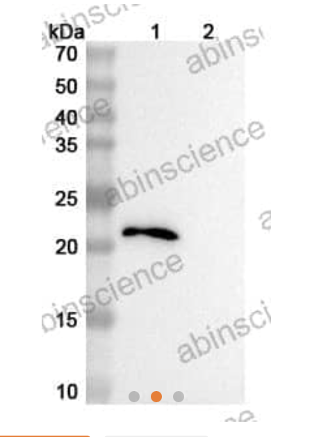 Abinscience InVivoMAb Anti-Human CCL11/Eotaxin Antibody (Iv0081) (HW762010-100ug)