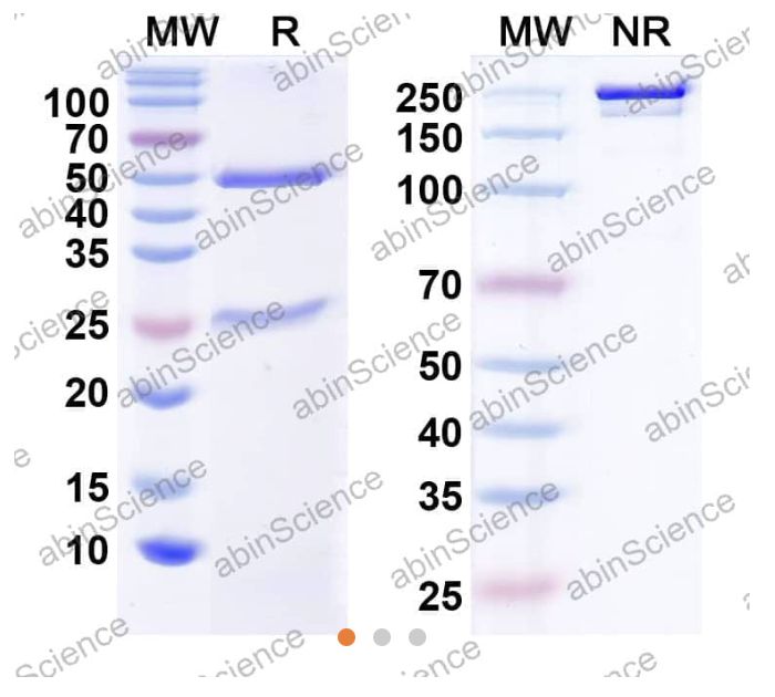 Abinscience InVivoMAb Anti-Human CCL11/Eotaxin Antibody (Iv0081) (HW762010-1mg)