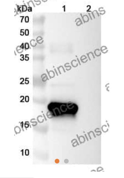Abinscience InVivoMAb Anti-Human G-CSF Antibody (Iv0054) (HY258010-100ug)