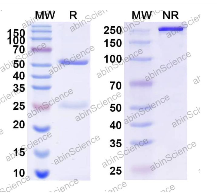 Abinscience InVivoMAb Anti-Human Apolipoprotein E/ApoE Antibody (HJ15.4) (HF739040-50ug)