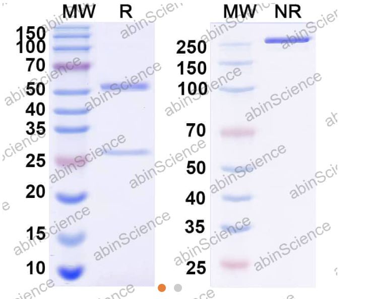 Abinscience InVivoMAb Anti-Human RAGE/AGER Antibody (7F9) (HS925010-50ug)