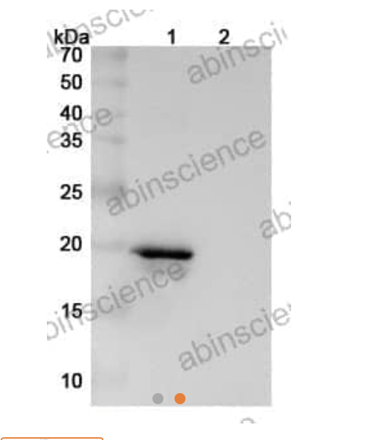 Abinscience InVivoMAb Anti-Human alpha-Synuclein Antibody (Iv0173) (HW755020-100ug)