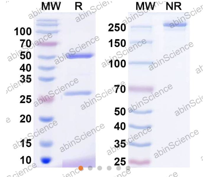 Abinscience InVivoMAb Anti-Human ACE-2 Antibody (3E8#) (HV157020-50ug) Abinscience InVivoMAb Anti-Human ACE-2 Antibody (3E8#) (HV157020-50ug)