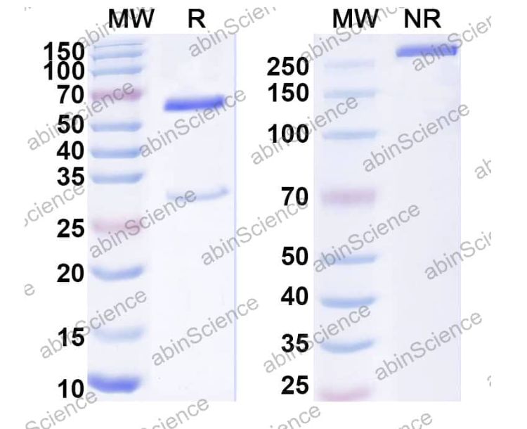 Abinscience Anti-Human Transthyretin amyloidosis Recombinant Antibody (14G8) (HP217023-100ug) Abinscience Anti-Human Transthyretin amyloidosis Recombinant Antibody (14G8) (HP217023-100ug)