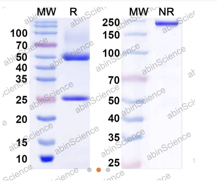 Abinscience InVivoMAb Anti-Human Apolipoprotein E/ApoE Antibody (Iv0128) (HF739010-50ug)