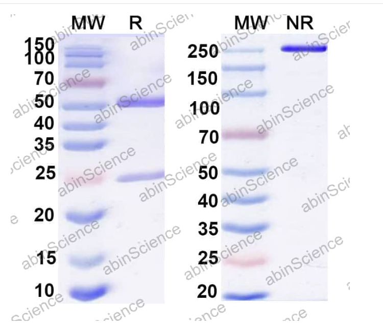 Abinscience InVivoMAb Anti-Human Erythropoietin R Antibody (V-1) (HB152020-1mg)