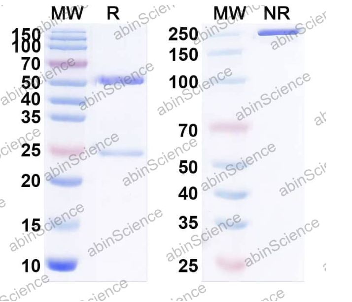 Abinscience InVivoMAb Anti-HMPV F/Fusion glycoprotein F0 Antibody (MPV467) (HK430010-50ug)