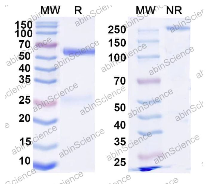 Abinscience InVivoMAb Anti-EV-D68 Capsid protein VP1/VP3/VP4 Antibody (Iv0269) (VK509010-1mg)
