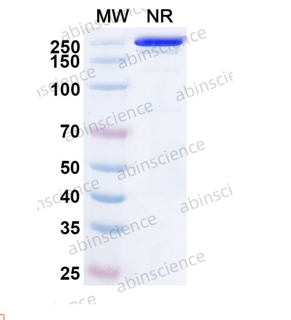 Abinscience InVivoMAb Anti-Chikungunya Virus/CHIKV VLP Antibody (m242) (VK425010-50ug)