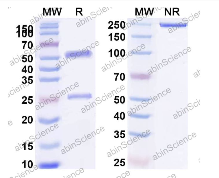Abinscience InVivoMAb Anti-HCV NS1/gp68/gp70/E2 Antibody (HC33.1) (VK681040-100ug)