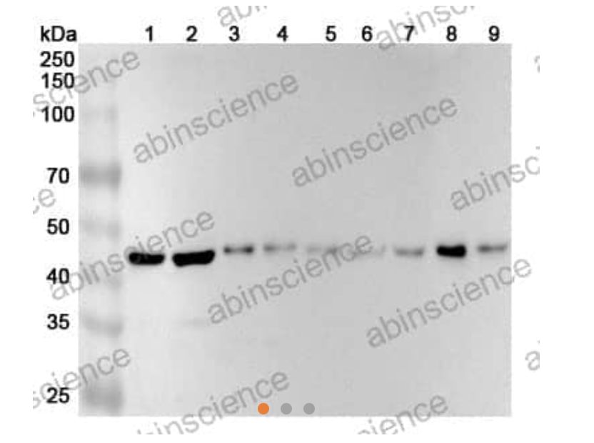 Abinscience InVivoMAb Anti-Human TSG101 Antibody (Iv0253) (HV181010-50ug)