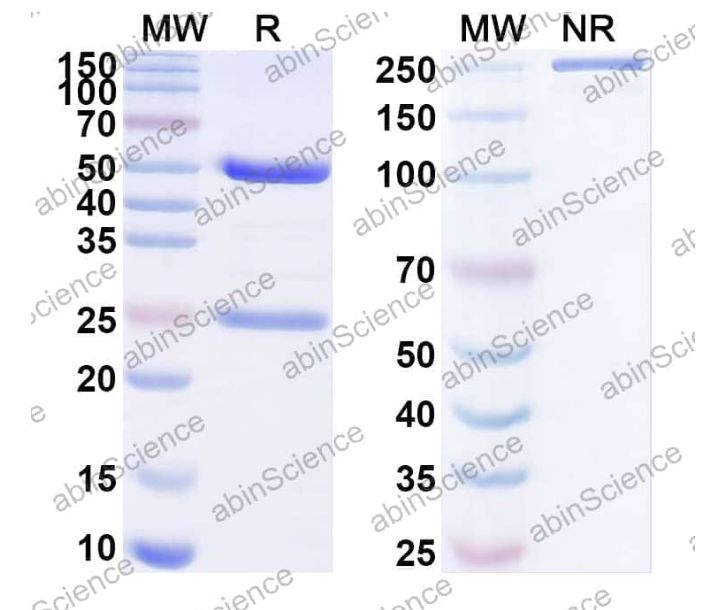 Abinscience InVivoMAb Anti-HCMV/HHV-5 gB Neutralizing Antibody (Ab3-25) (VK665020-100ug)