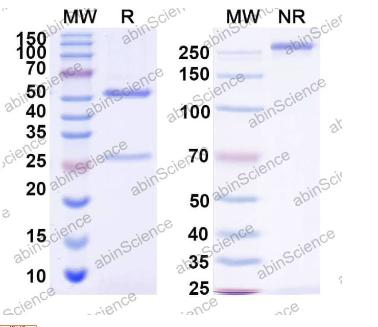 Abinscience InVivoMAb Anti-HIV-1 Protease Antibody (F11.2.32) (VK492010-1mg)