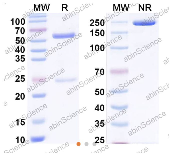 Abinscience InVivoMAb Anti-Human TSG101 Antibody (Iv0254) (HV181020-100ug)