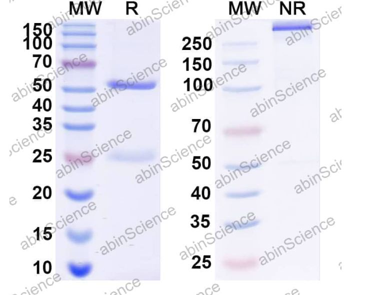 Abinscience InVivoMAb Anti-Plasmodium falciparum PF45/48 Antibody (TB31F) (JN900010-100ug)