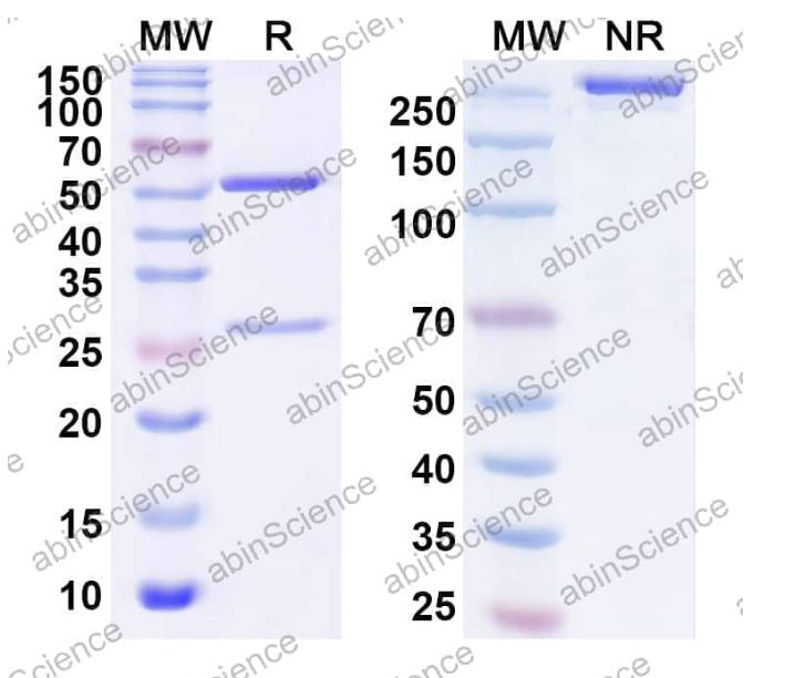 Abinscience InVivoMAb Anti-SARS-CoV-2 RBD Antibody (PR953) (VK565090-100ug)