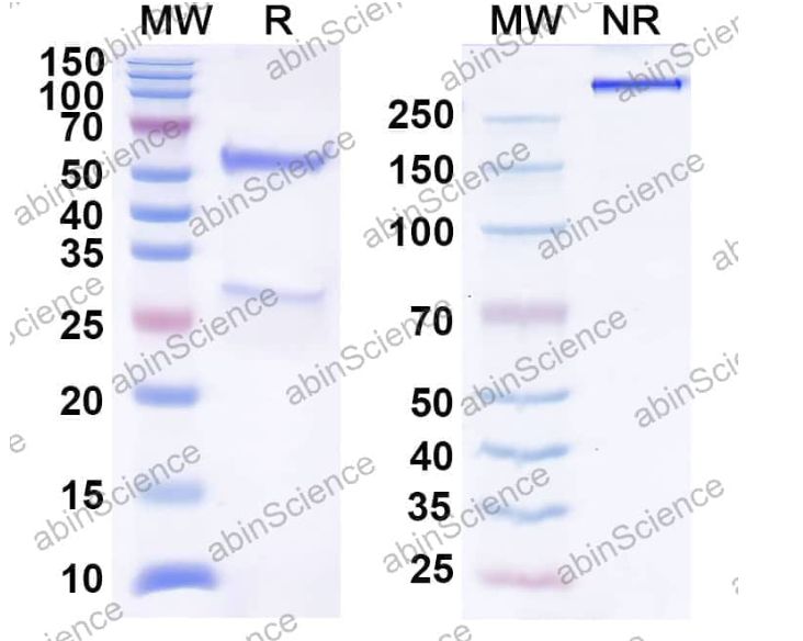 Abinscience InVivoMAb Anti-PCV2 Cap/Capsid protein Antibody (1E7#) (VK411010-1mg)
