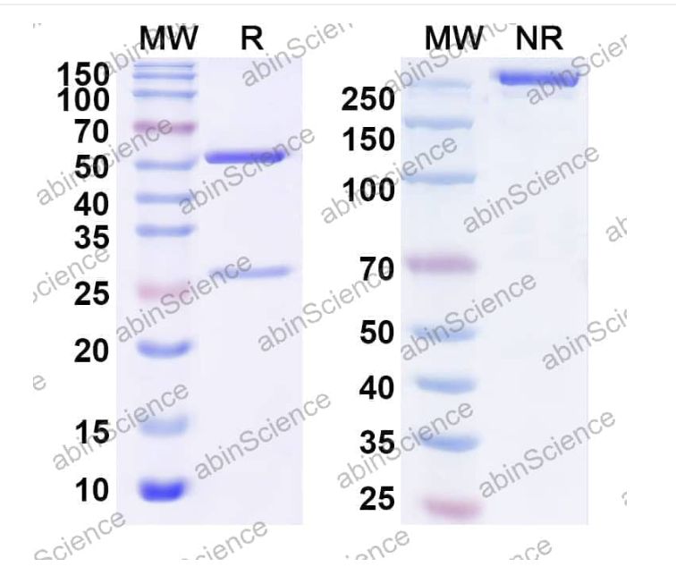 Abinscience InVivoMAb Anti-SARS-CoV-2 RBD Antibody (PR961) (VK565100-1mg)