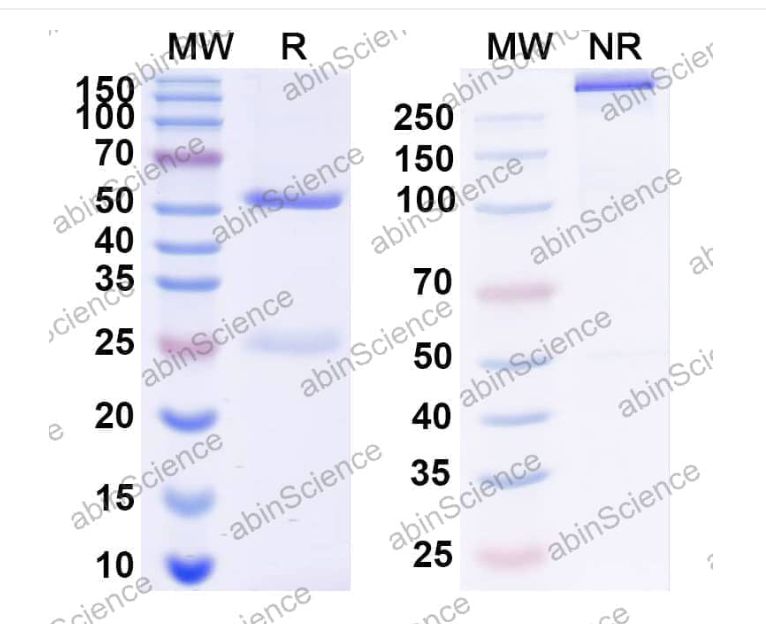 Abinscience InVivoMAb Anti-Plasmodium falciparum PF45/48 Antibody (85RF45.1) (JN900020-100ug)