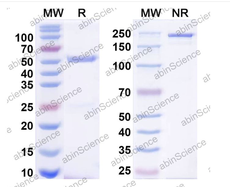 Abinscience InVivoMAb Anti-Human LRRC15 Antibody (Iv0219) (HV777010-100ug)