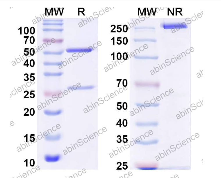 Abinscience InVivoMAb Anti-DENV-2 Envelope protein E/EDIII domain Antibody (3H5) (VK589040-1mg) Abinscience InVivoMAb Anti-DENV-2 Envelope protein E/EDIII domain Antibody (3H5) (VK589040-1mg)