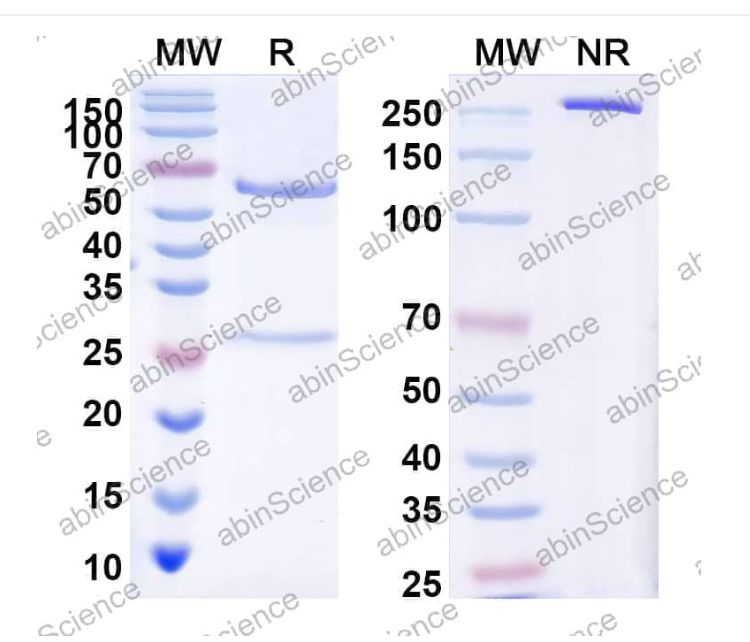 Abinscience InVivoMAb Anti-Human ROR1 Antibody (2A2) (HX065010-100ug) Abinscience InVivoMAb Anti-Human ROR1 Antibody (2A2) (HX065010-100ug)