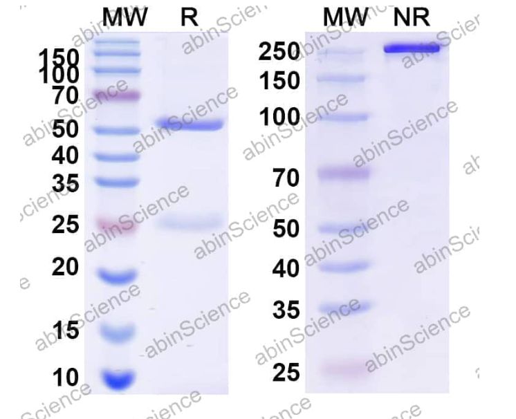 Abinscience InVivoMAb Anti-Human IL-31 Antibody (Iv0206) (HV678010-1mg)