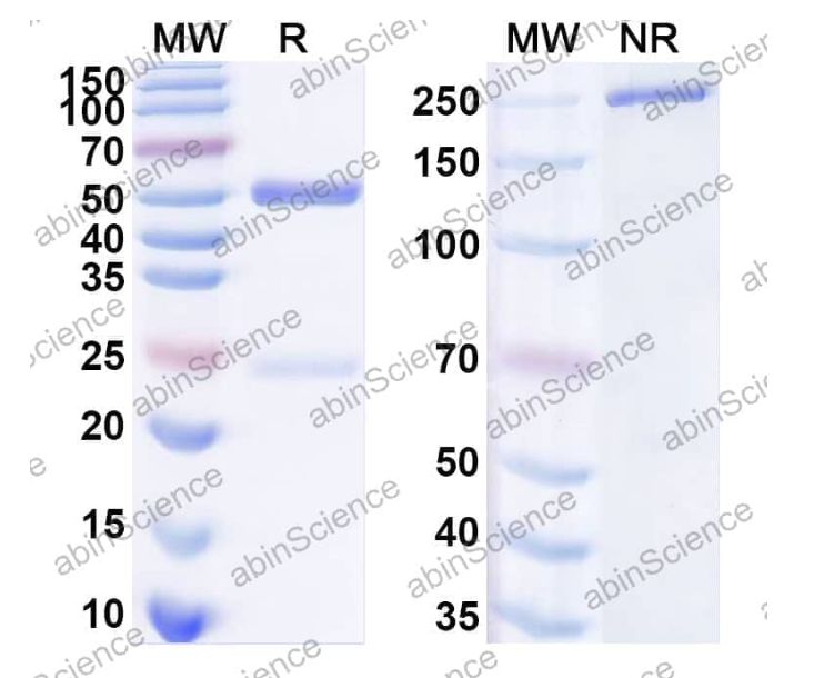 Abinscience InVivoMAb Anti-pan SARS-CoV-2 RBD Antibody (1H1) (VK565020-1mg)
