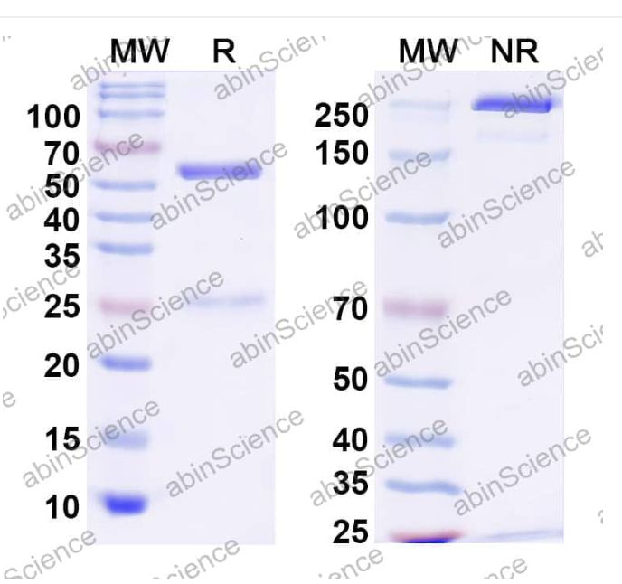 Abinscience InVivoMAb Anti-SARS-CoV-2 Spike Protein Antibody (Iv0205) (VK565040-1mg)