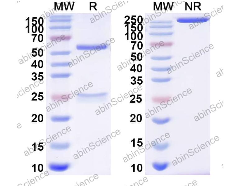 Abinscience InVivoMAb Anti-EV71 Procapsid Antibody (E5RPG0) (VK633020-100ug)