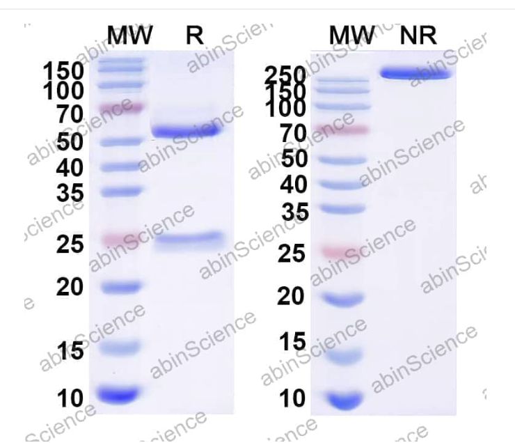 Abinscience InVivoMAb Anti-Nipah virus/NiV Fusion glycoprotein/F Trimer Antibody (Fab92) (VK521070-50ug)