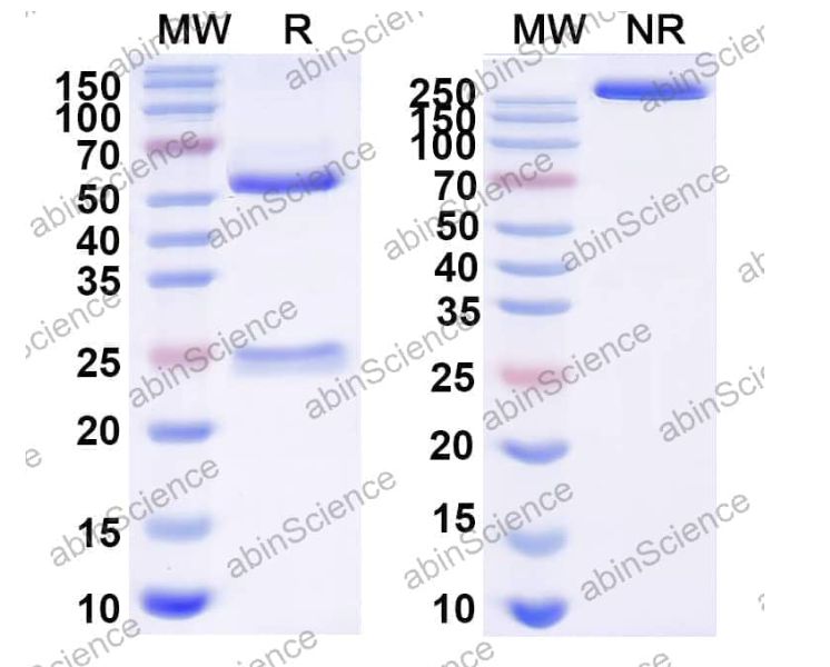 Abinscience InVivoMAb Anti-EV71 Mature virion in Complex Antibody (A9) (VK633030-1mg)