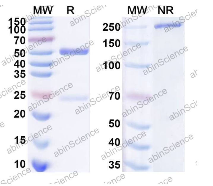 Abinscience InVivoMAb Anti-pan SARS-CoV-2 RBD Antibody (5E1#) (VK565030-1mg)