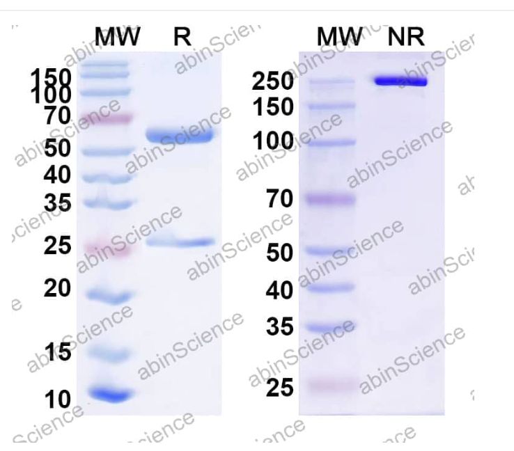 Abinscience InVivoMAb Anti-Nipah virus/NiV F/Fusion glycoprotein F0 Antibody (2D3) (VK521040-50ug)