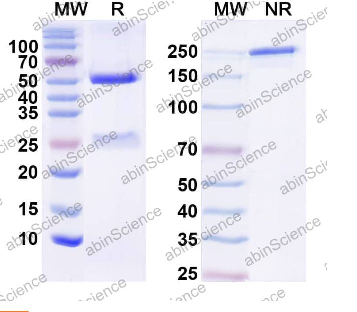 Abinscience InVivoMAb Anti-Human TREM2 Antibody (42E8#) (HV166010-100ug)