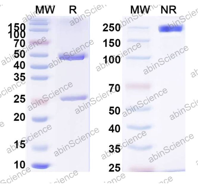 Abinscience InVivoMAb Anti-HBV-A S/L-HBsAg/L glycoprotein Antibody (Iv0190) (VK539050-50ug)