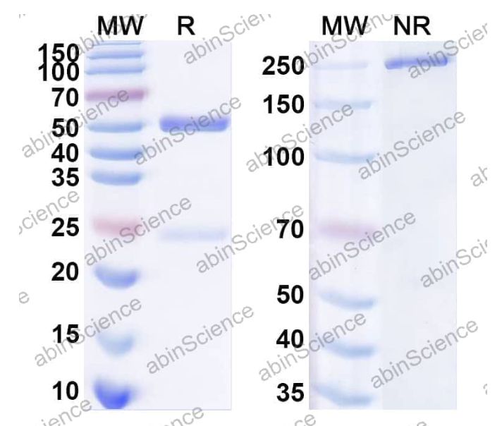 Abinscience InVivoMAb Anti-HIV-1 env/Env polyprotein Antibody (CH59) (VK617080-1mg)