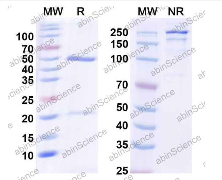 Abinscience InVivoMAb Anti-Human Transglutaminase 2/TGM2 Antibody (52F3) (HB247010-100ug)