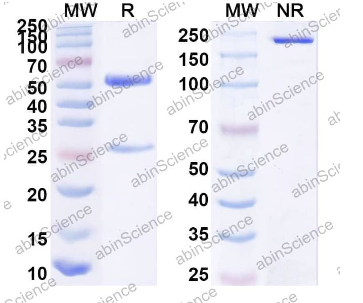 Abinscience InVivoMAb Anti-HBV-A S/L-HBsAg/L glycoprotein Antibody (Iv0189) (VK539040-50ug)