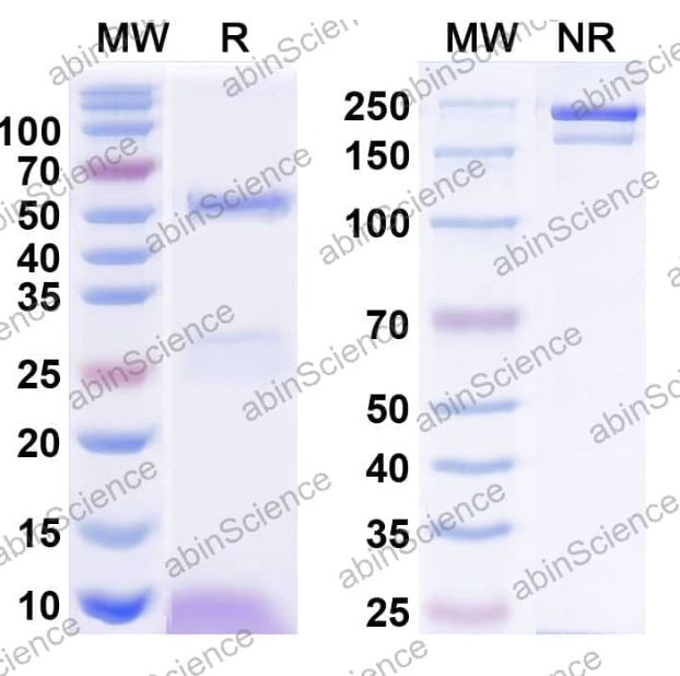 Abinscience InVivoMAb Anti-Human HTRA1/PRSS11 Antibody (Iv0191) (HV033010-50ug)
