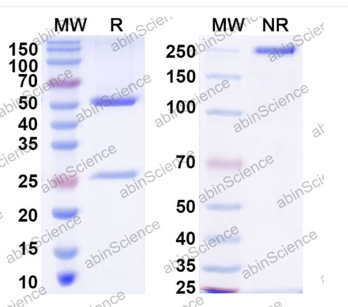Abinscience InVivoMAb Anti-Escherichia coli shiga toxin type 2/stx2B Antibody (Iv0194) (JN832010-100ug)