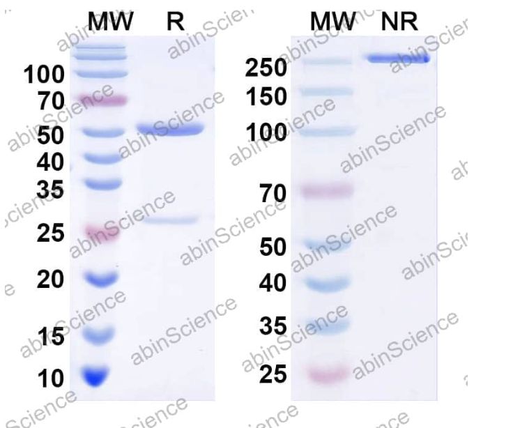 Abinscience InVivoMAb Anti-Human MASP2 Antibody (17D20) (HT020010-50ug)
