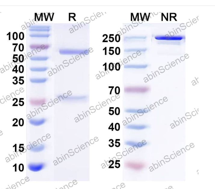 Abinscience InVivoMAb Anti-Human MUC5AC Antibody (Iv0182) (HX246010-100ug)
