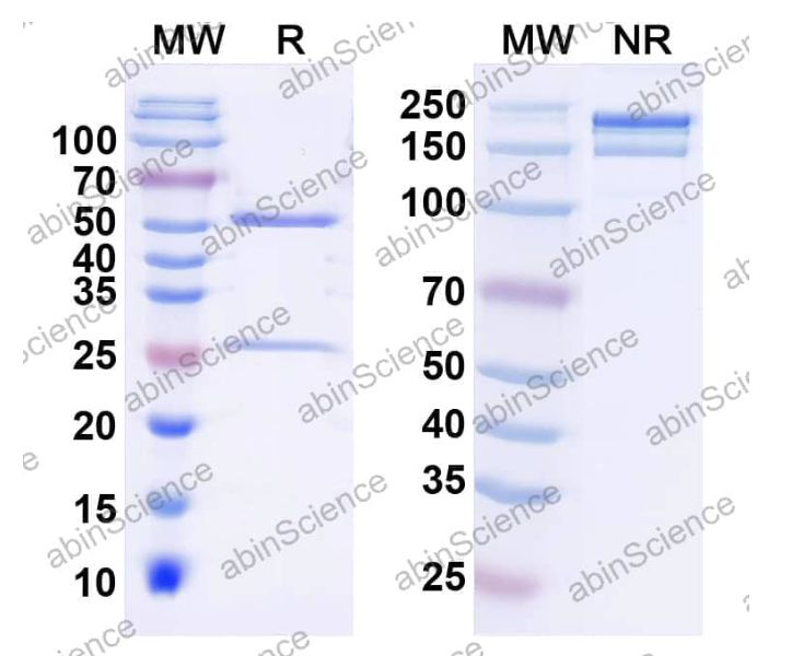 Abinscience InVivoMAb Anti-Clostridioides difficile Toxin B/tcdB Antibody (CDB-1) (HN876010-1mg)