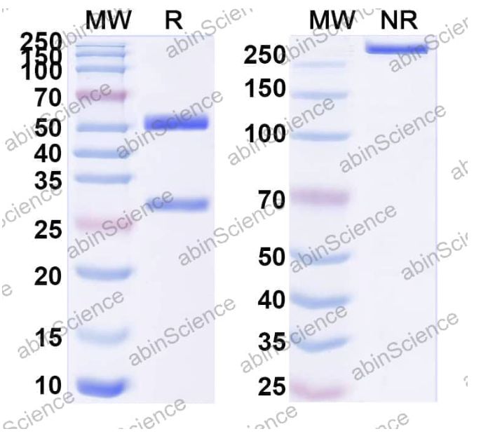 Abinscience InVivoMAb Anti-Human astrovirus-8//HAstV Capsid protein VP25 Antibody (3E8#) (VK821010-50ug)